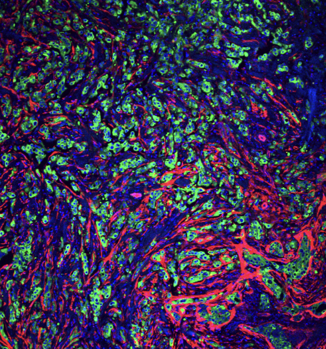Cancer-associated fibroblasts